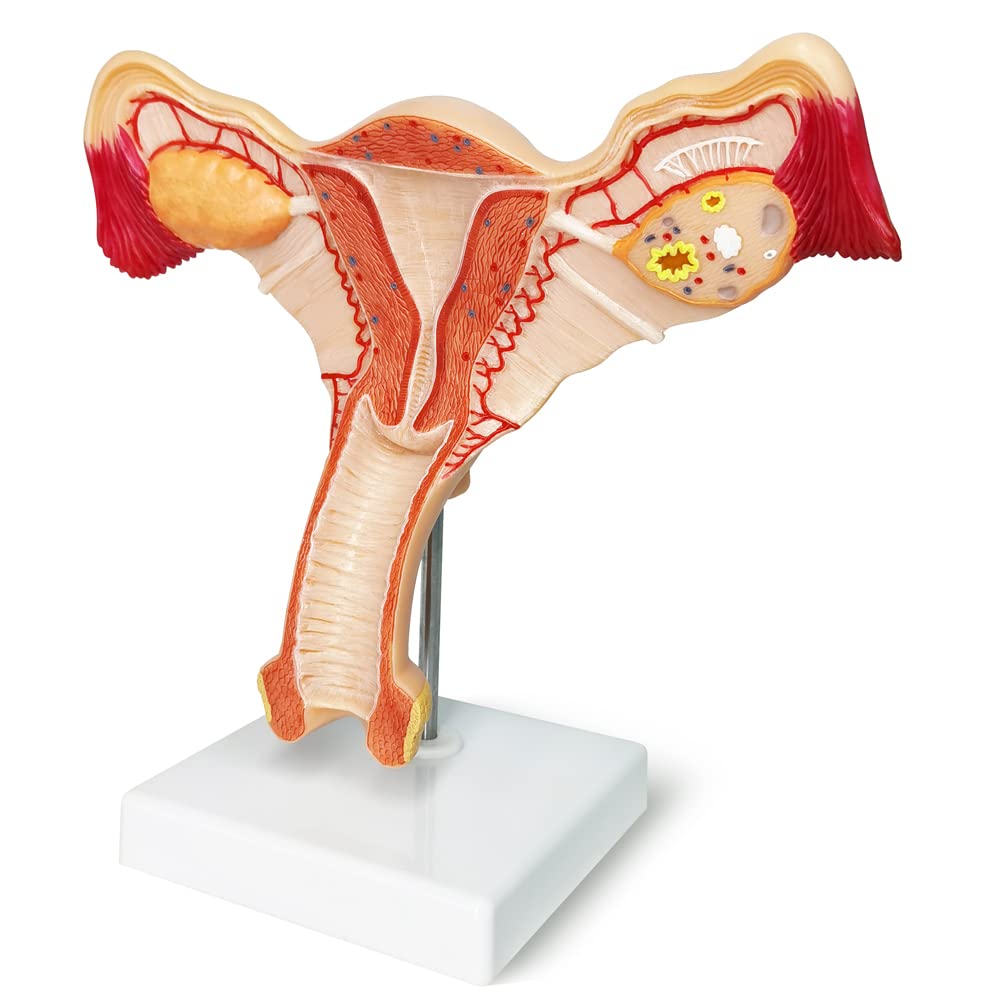 Evotech Scientific Human Uterus and Ovary Model Female Genital Organs Model