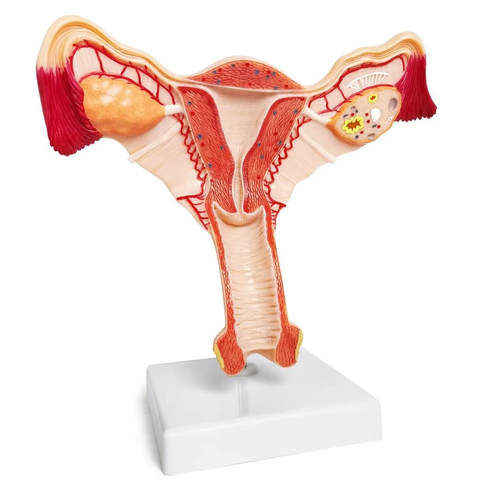 Evotech Scientific Human Uterus and Ovary Model Female Genital Organs Model