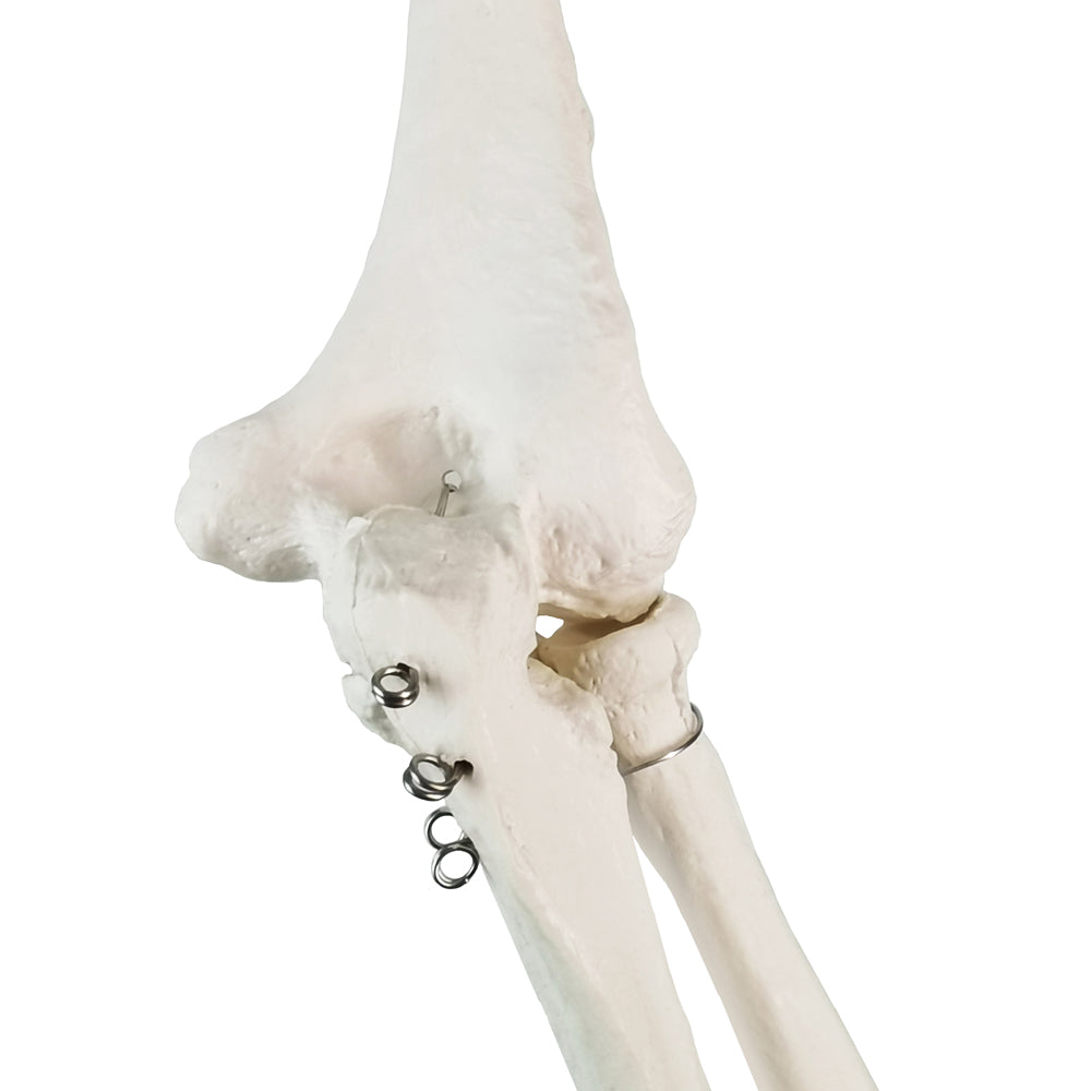 Evotech Scientific Life-Size Human Right Arm Skeleton Model