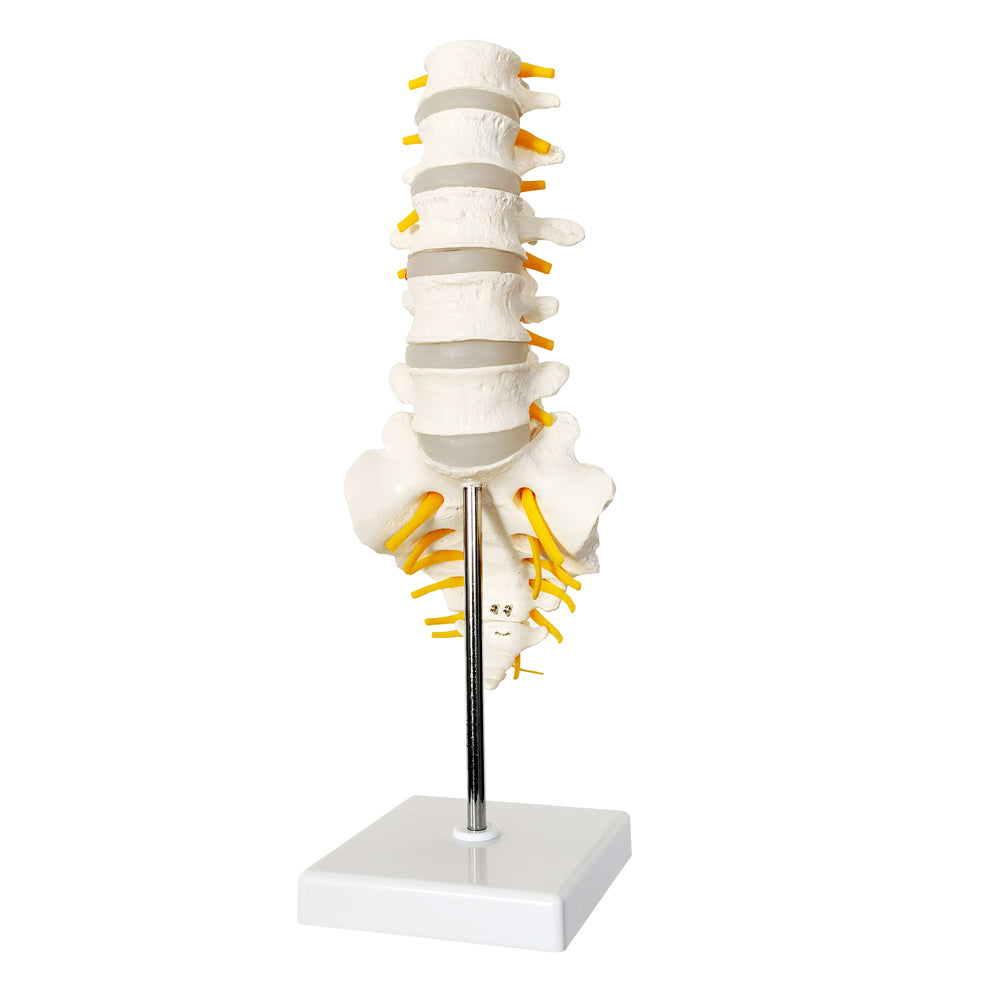 Evotech Scientific Lumbar Vertebral Column with Sacrum and Spinal Nerves Anatomy Model, Herniated Disc at L4