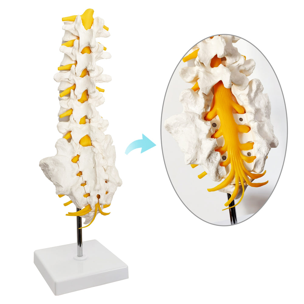 Evotech Scientific Lumbar Vertebral Column with Sacrum and Spinal Nerves Anatomy Model, Herniated Disc at L4