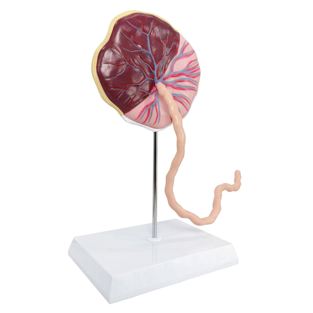Evotech Scientific Placenta Model with Removable Umbilical Cord Anatomical Model