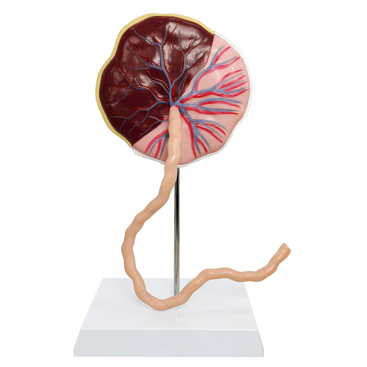 Evotech Scientific Placenta Model with Removable Umbilical Cord Anatomical Model