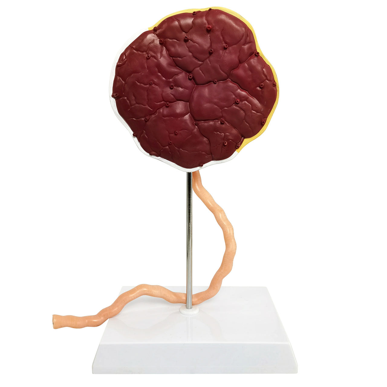 Evotech Scientific Placenta Model with Removable Umbilical Cord Anatomical Model
