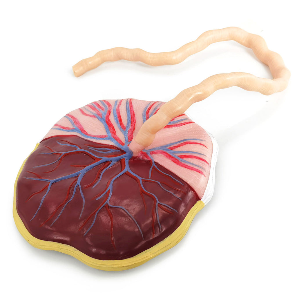 Evotech Scientific Placenta Model with Removable Umbilical Cord Anatomical Model