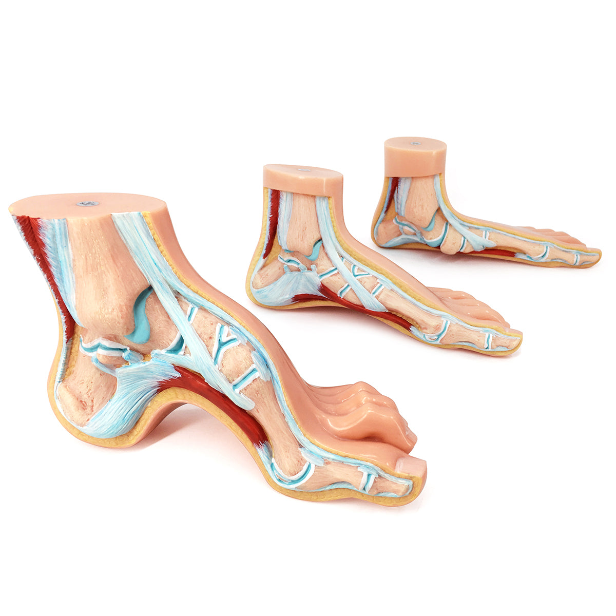 Evotech Scientific Podiatry Anatomy Models, Set of 3 Human Feet Flat Foot, Normal Foot and a High Arch