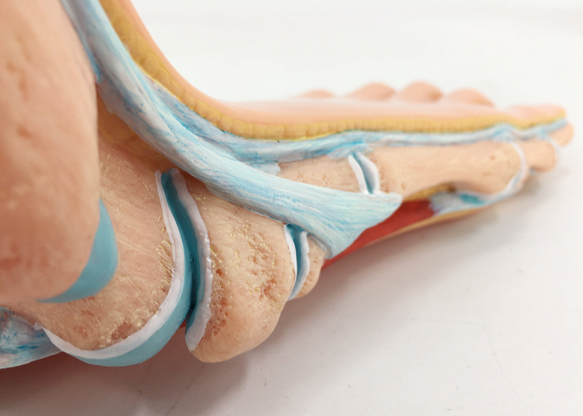 Evotech Scientific Podiatry Anatomy Models, Set of 3 Human Feet Flat Foot, Normal Foot and a High Arch