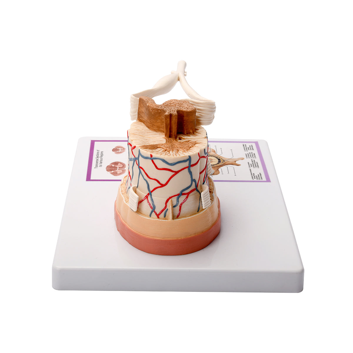 Evotech Scientific Spinal Cord W/ Nerve Endings