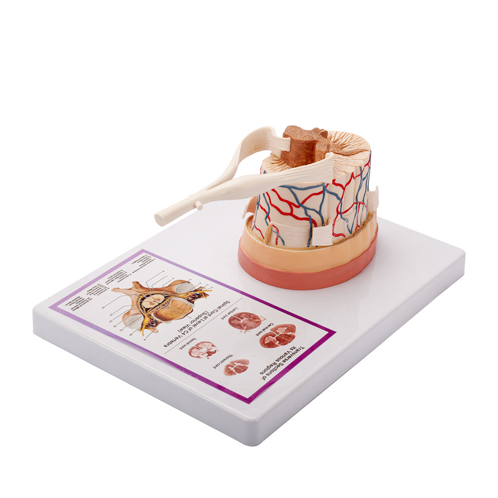 Evotech Scientific Spinal Cord W/ Nerve Endings