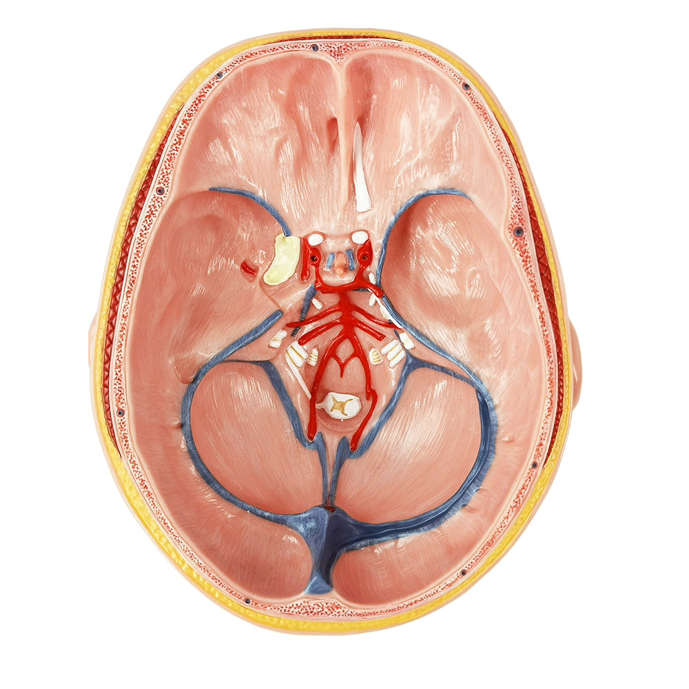 Evotech Scientific Deluxe Anatomy Human Brain w/ Arteries on base of head 10 Parts