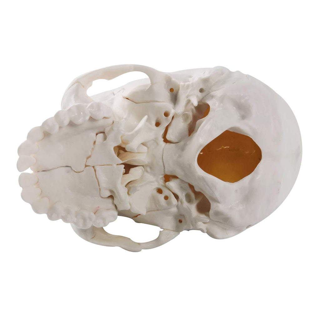 Evotech Scientific Life-Size 22-Part Disarticulated Human Skull Anatomy Model