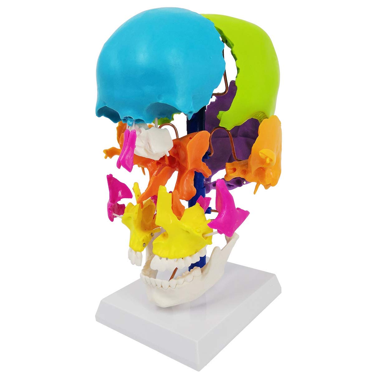 Evotech Scientific Life-Size Disarticulated Anatomy Human Skull Model