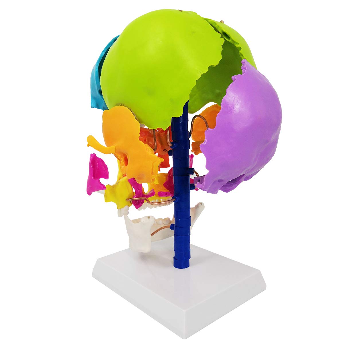 Evotech Scientific Life-Size Disarticulated Anatomy Human Skull Model