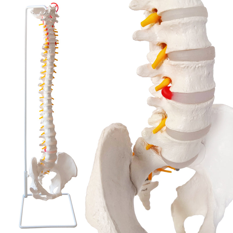 Evotech Scientific Life Size Anatomical Spine Model with Vertebrae, Nerves, Arteries, Lumbar Column, and Male Pelvis